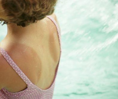 FixTanLines-595
